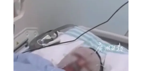 男子骑电动车接孩子突然爆燃 妻子70%深度烧伤